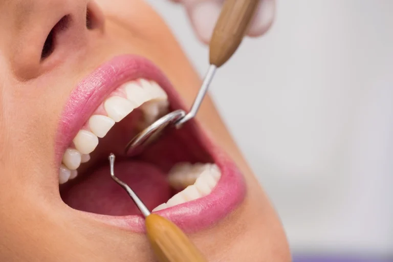 como funciona um plano odontológico
